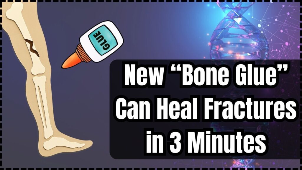 New “Bone Glue” Can Heal Fractures in 3 Minutes